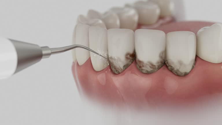 Trusted Wisdom Tooth Removal service in Ione, CA - Dentist Open Now